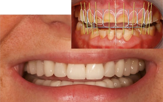 Cosmetic Dentistry & Aesthetic Restorative Dentistry 