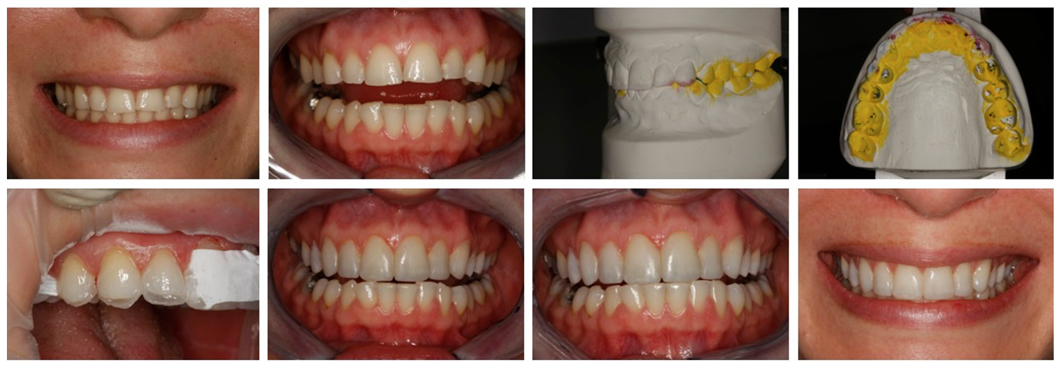 Advanced Occlusion and Treatment Planning