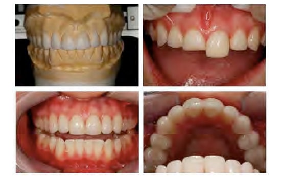 Comprehensive Dentistry: Mastering Aesthetics and Function