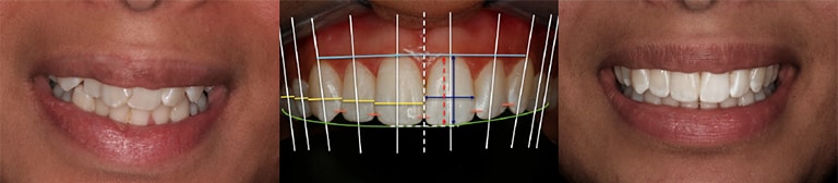 Aesthetic Restorative Dentistry