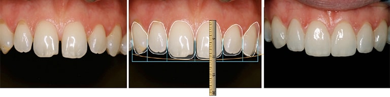 restorative dentistry