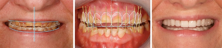 Dental Treatment Planning